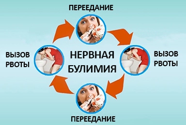 Лечение булимии в Усть-Катаве